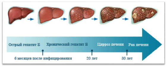 В чем заключается профилактика вирусного гепатита в. b25c16629b4a955d530c02c189f3a060. В чем заключается профилактика вирусного гепатита в фото. В чем заключается профилактика вирусного гепатита в-b25c16629b4a955d530c02c189f3a060. картинка В чем заключается профилактика вирусного гепатита в. картинка b25c16629b4a955d530c02c189f3a060