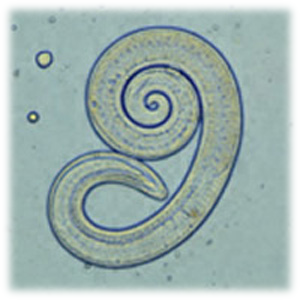 Trichinella spiralis что это. f77c08808bcc364cb2143e639b2a0144. Trichinella spiralis что это фото. Trichinella spiralis что это-f77c08808bcc364cb2143e639b2a0144. картинка Trichinella spiralis что это. картинка f77c08808bcc364cb2143e639b2a0144